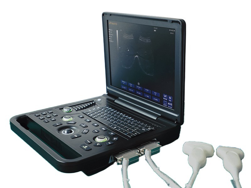 All-Digital Portable Laptop Ultrasound Diagnostic System for Clinic Doctor