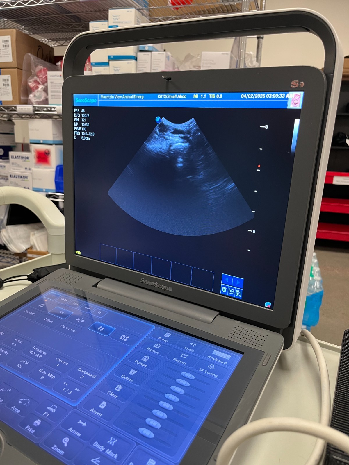 2018 Sonoscape S9 Portable Digital Color Doppler Ultrasound System