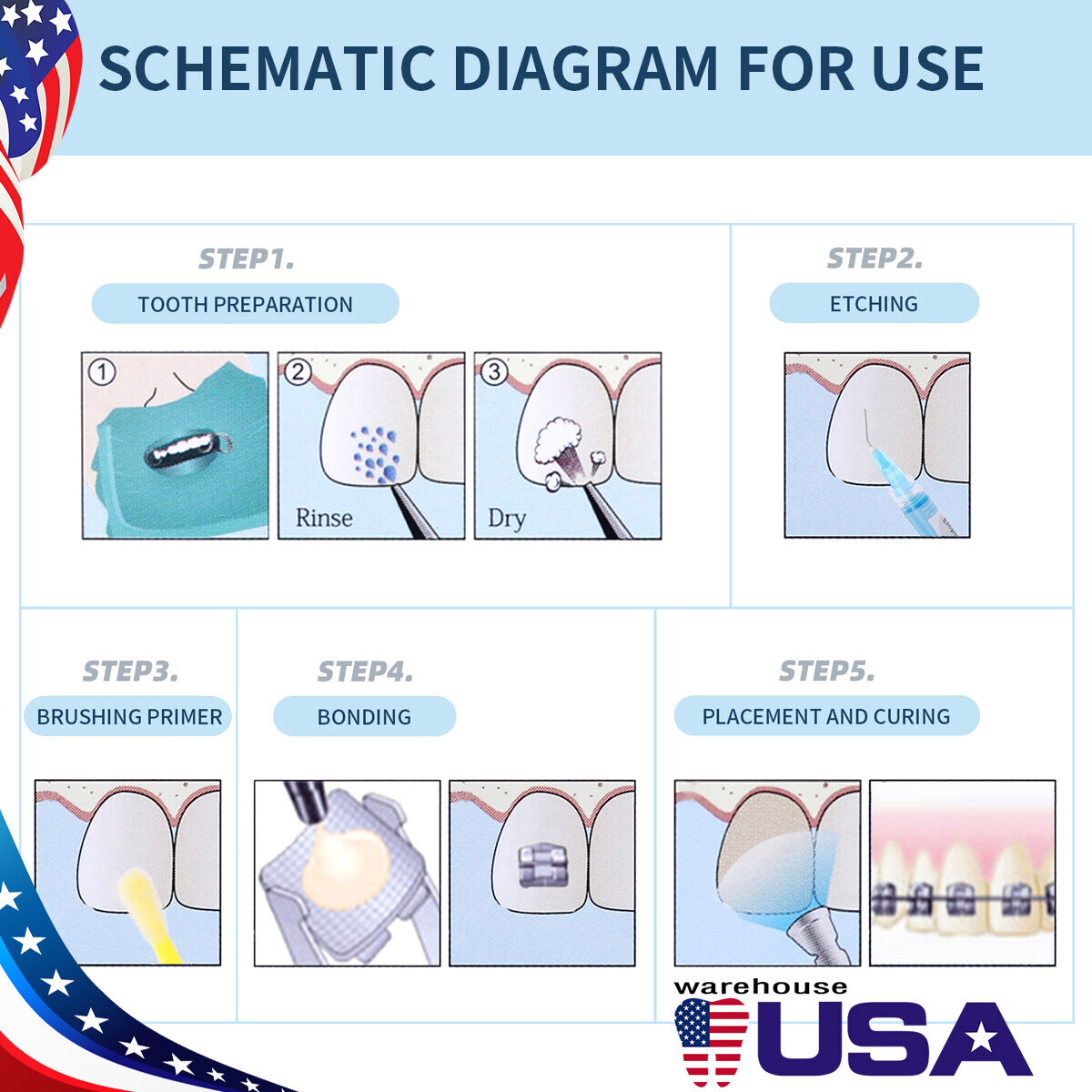 Dental Orthodontic Light Cure Bracket Braces Glue Bonding Resin/Etching Gel