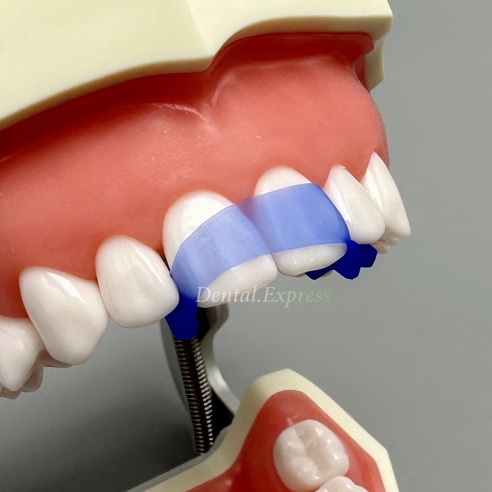 Dental Elastic Wedges Protector Anterior Front Teeth Isolating Matrices Strip
