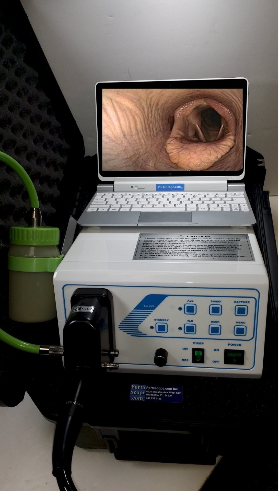 Aohua LG-200 9mm X 150cm Veterinary Video Endoscope Endoscopy System and PC