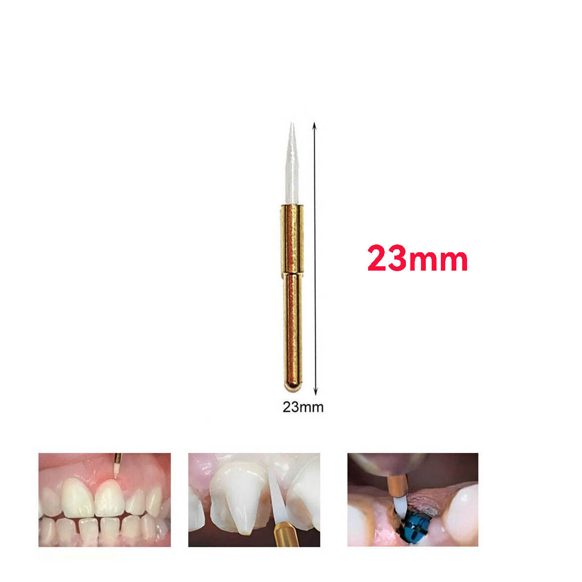Dental Soft Trimmer Burs Ceramic Soft Tissue Gingival Retraction FG 23mm