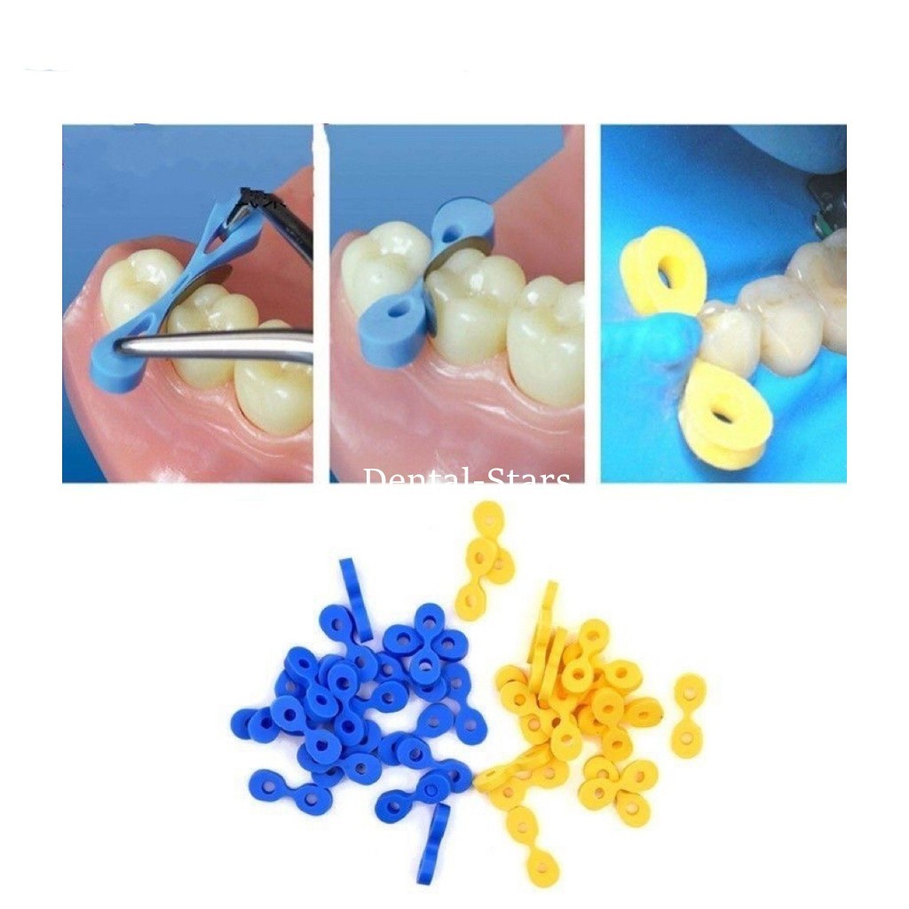 40Pcs Dental Wedges Elastic Rubber Teeth Separator Wedge Fixation For Tooth Gap