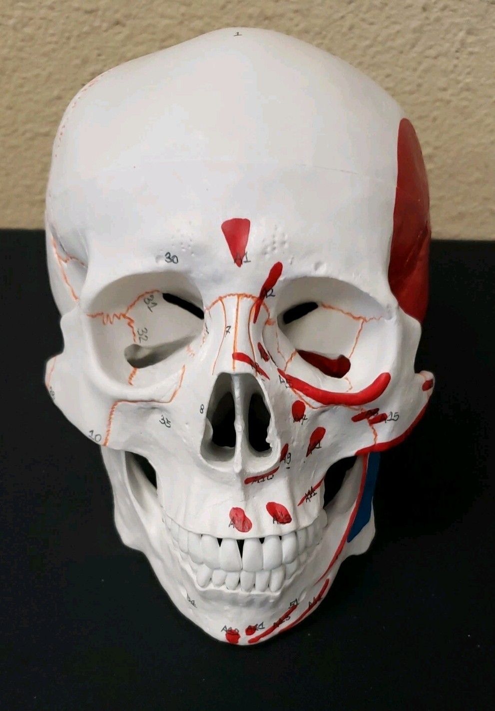 Vision Scientific VAL208 A Life-Size Human Skull Medical Grade New