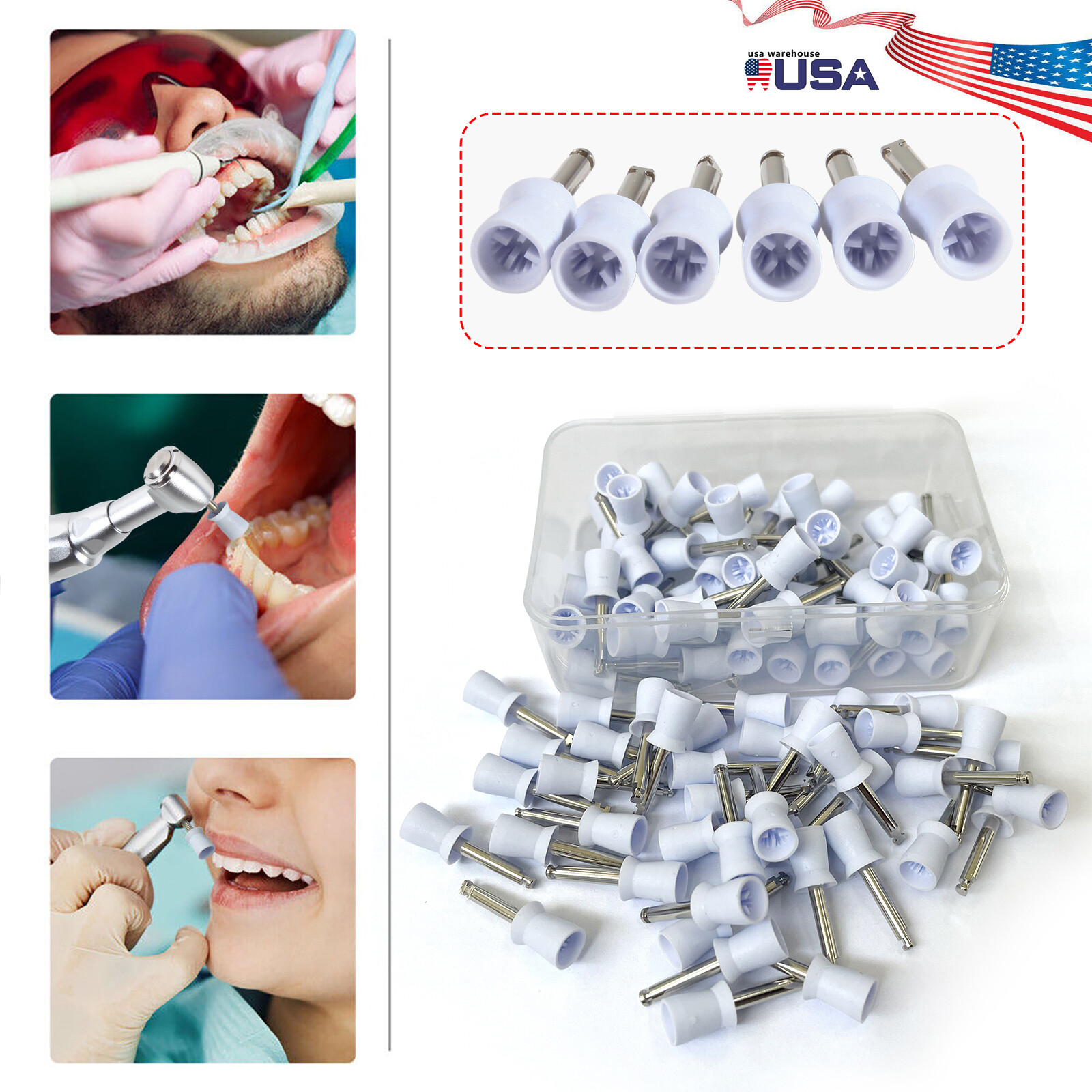 100pcs Dental Polishing Polish Cups Prophy Cup Latch Type Brush Rubber SJ