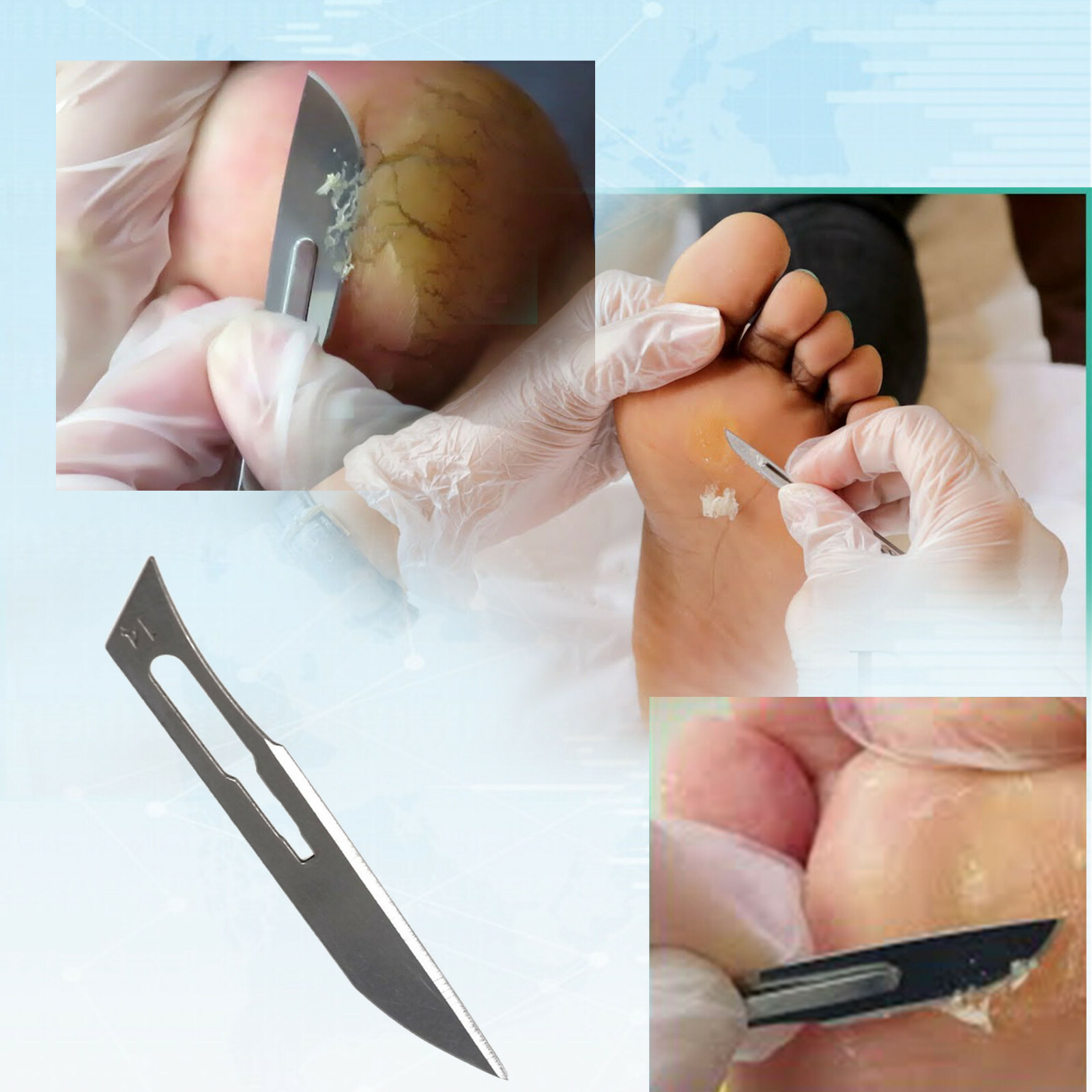 100 Scalpel Blades#14 +#3 Metal Handle + Blade Remover Craft, Stencil Making