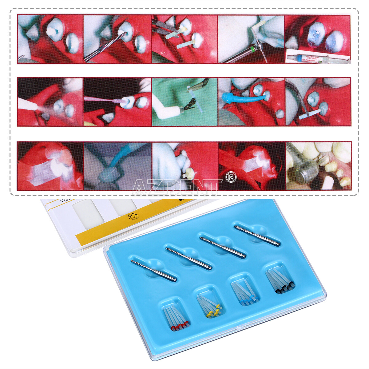 10X Dental AAA Endodontic Fiber Post Kit 1.2mm 1.4mm 1.6mm 1.8mm+Drills