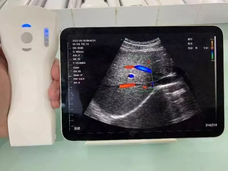 Wifi Wireless Color Ultrasound Doppler Scanner 256E 3 in 1 (64 Channels)