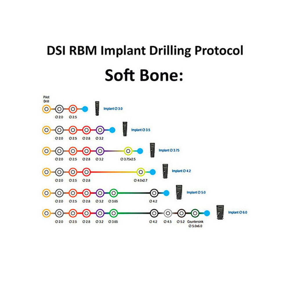 DSI Dental Spiral Implant Premium Internal Hex Sterile 5.0 x 8mm, 1/Pk