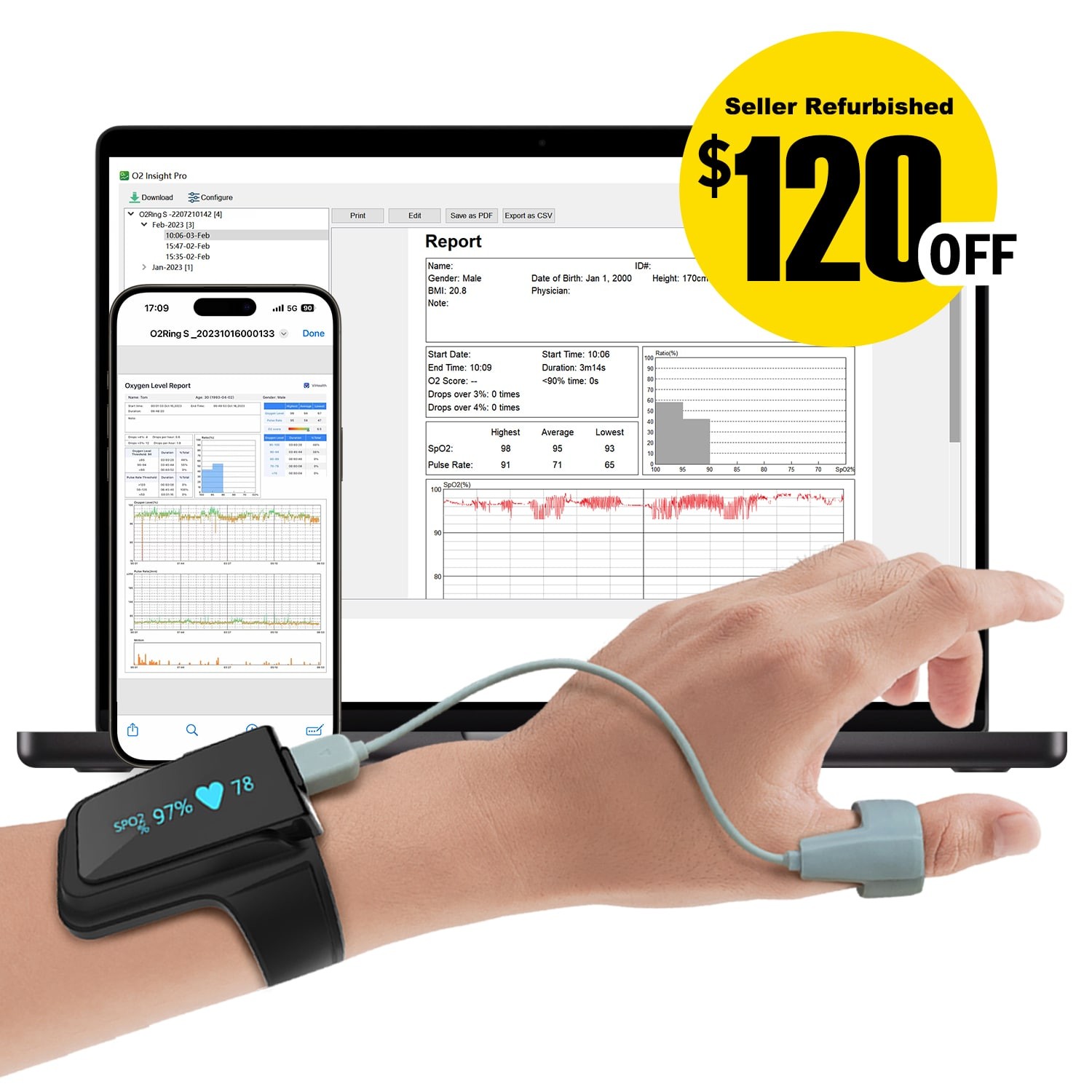 Wellue O2 Max Oximeter Continuous Recording SpO2 & PR with Free App & PC Reports