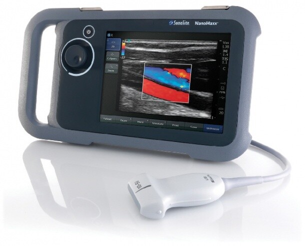 SONOSITE NANOMAXX PORTABLE TOUCH ULTRASOUND CARDIO IMAGING DOPPLER IMAGE SCANNER