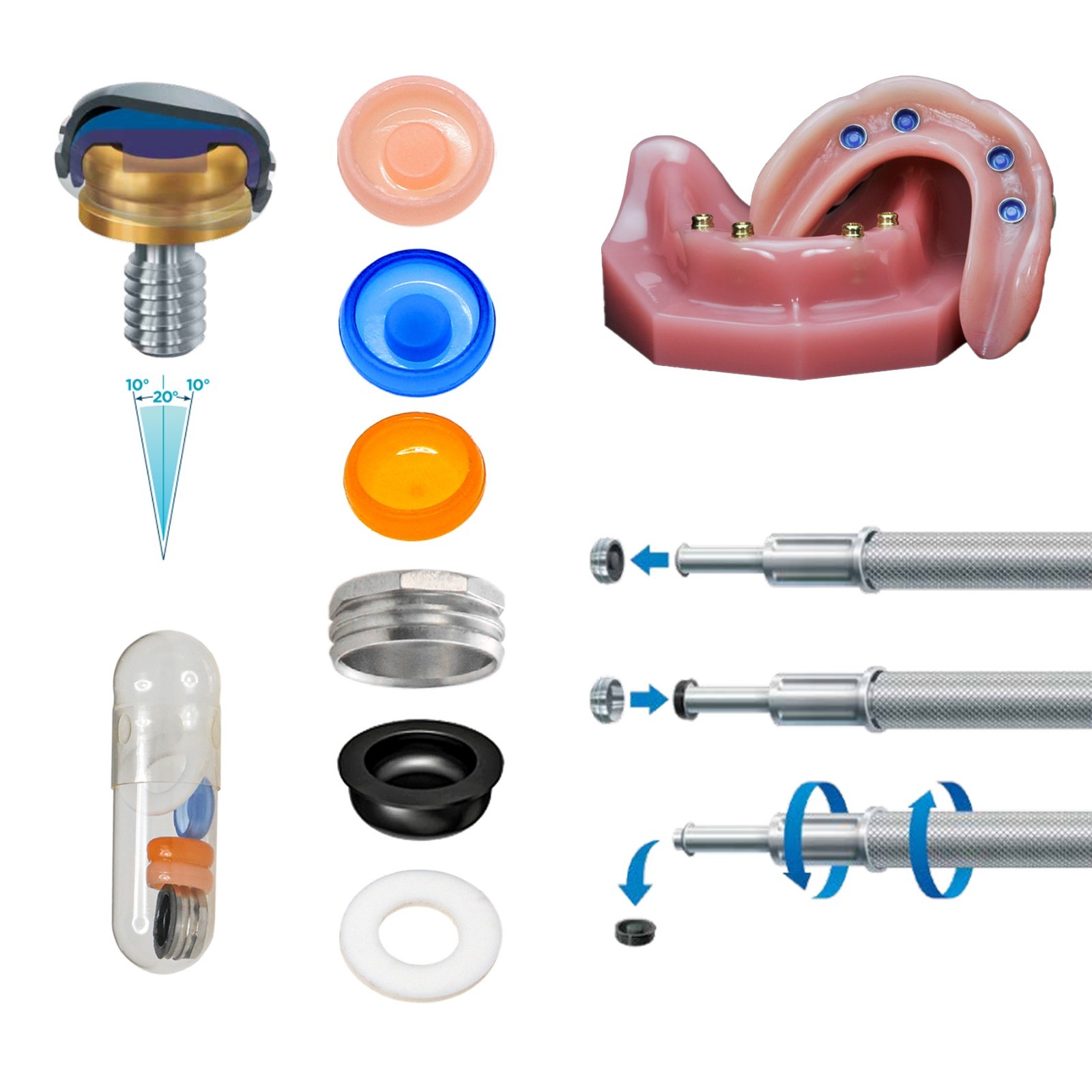 Dental Zest Locator Overdenture Attachment System Compatible Multiple Implant