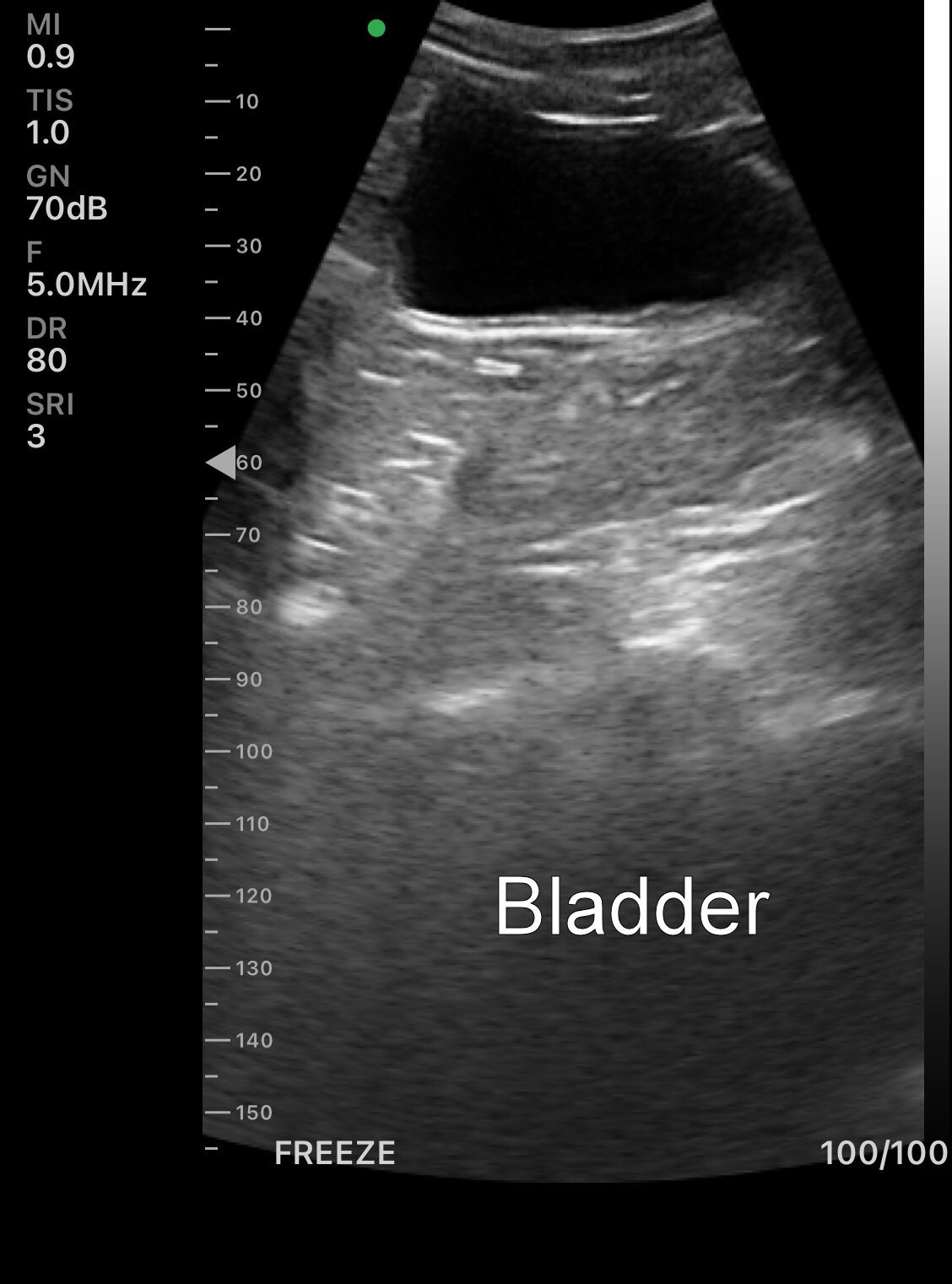 Wifi Wireless Pocket Ultrasound BUY USA, Cardiac Linear Convex Color Doppler