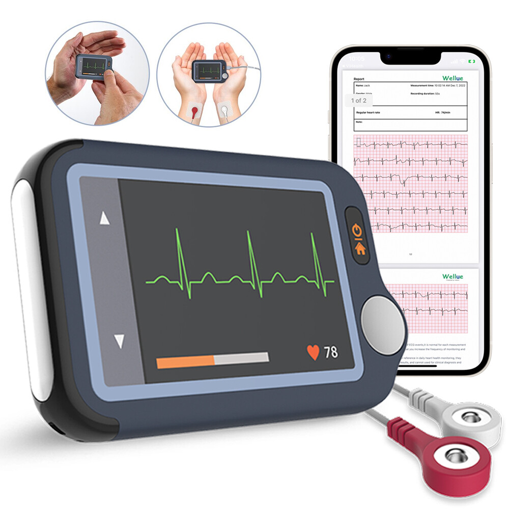 ECG EKG Monitor Heart Monitor with free AI ECG Analysis 30s/60s/5min Recording