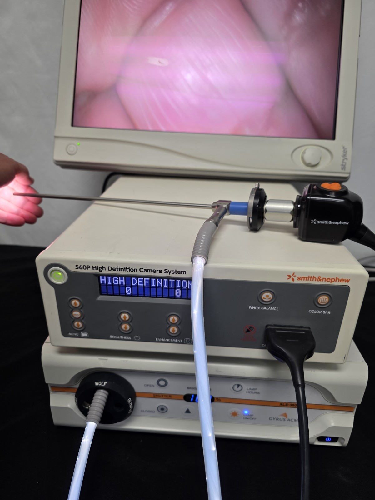 Smith & Nephew 560P HD Camera System w/ Light Source, 21″ Monitor & Scope (GOOD)