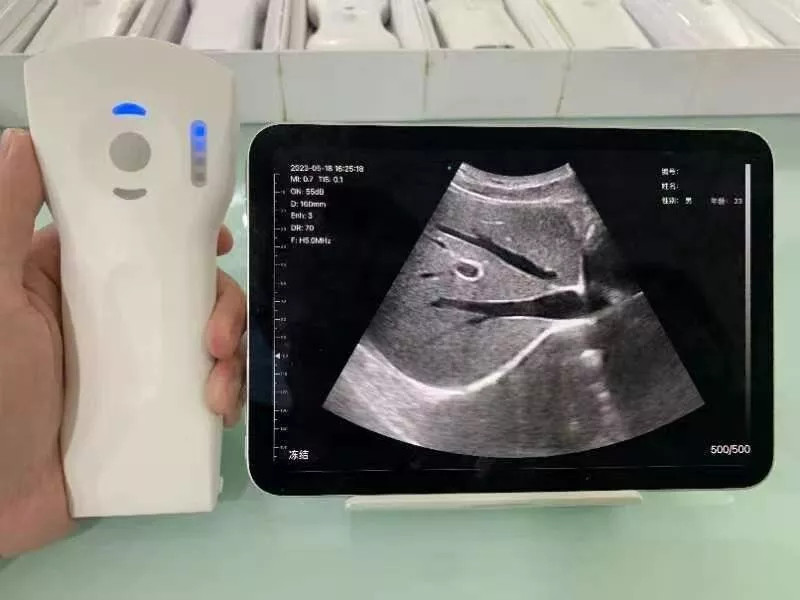 Wifi Wireless Color Ultrasound Doppler Scanner 256E 3 in 1 (64 Channels)