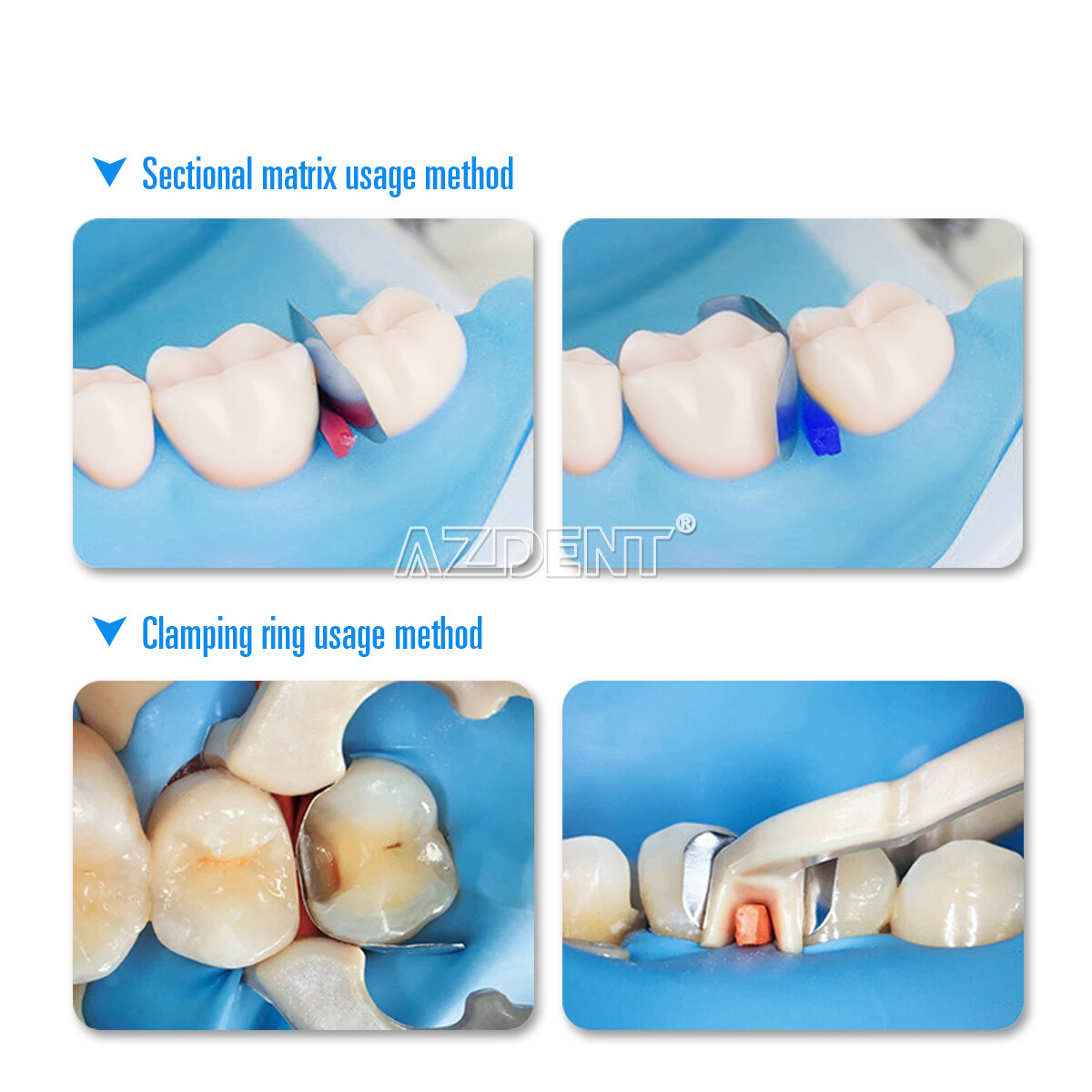 Dental Sectional Contoured Metal Matrices Refill Matrix Band /Diastema Wedges