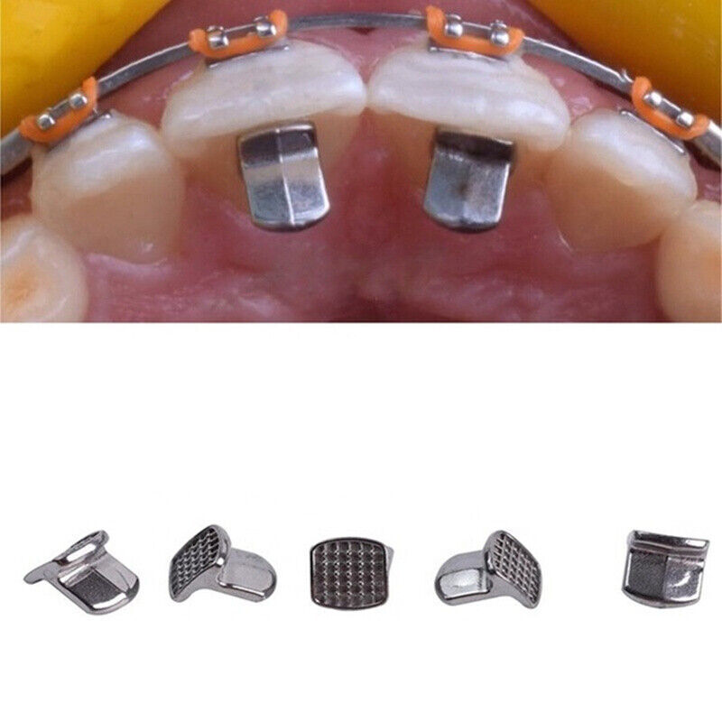 10Pcs Dental Orthodontic Bite Opener Tongue Bite Tamers Turbos Opener Bite Wings