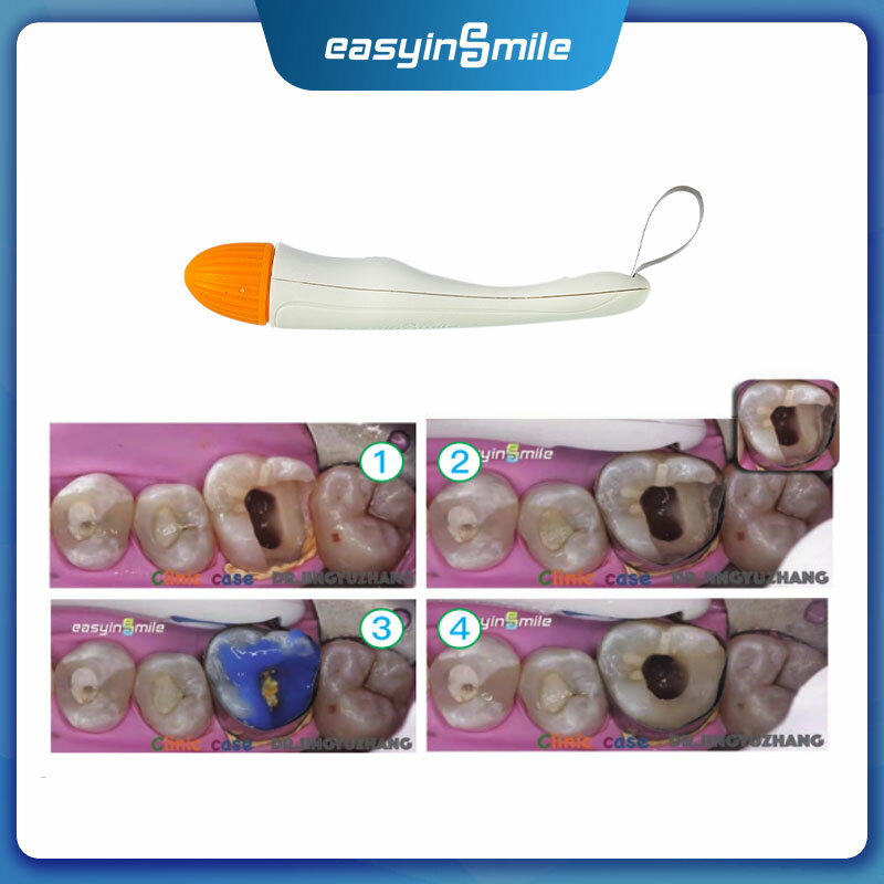 10Pcs Easyinsmile Dental Pro Matrix Band Ring Adjustable Matrices Standard 4.5mm