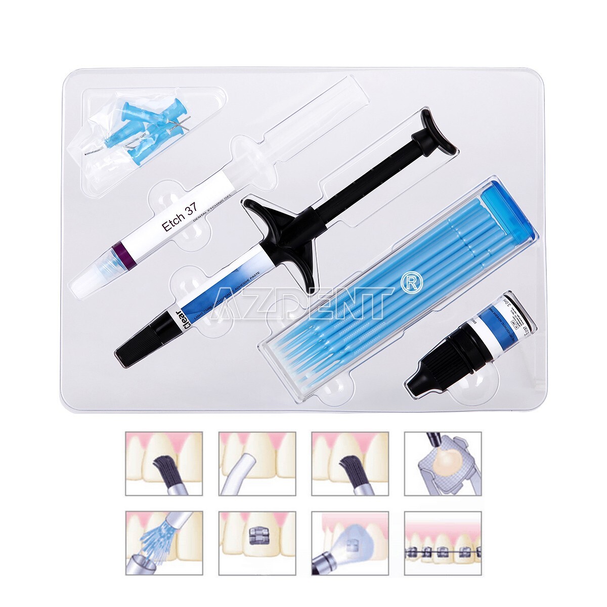 Dental Orthodontic Light Cure Adhesive Paste Acid Etchant Bonding Blue Glue Kits