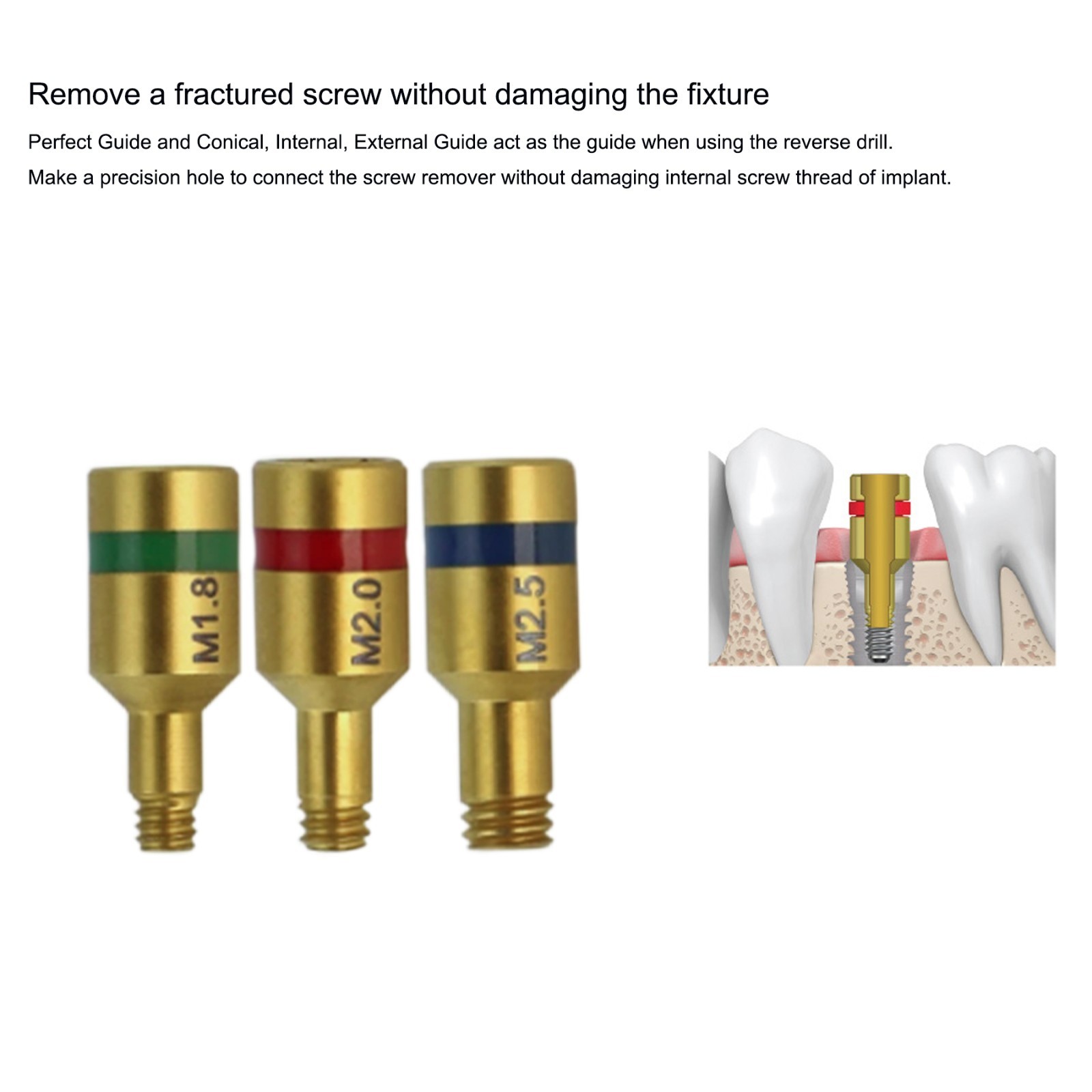 US Implant Fixture & Fractured Screw Removal Kit MCT FSRK-02 NeoBiotech SR