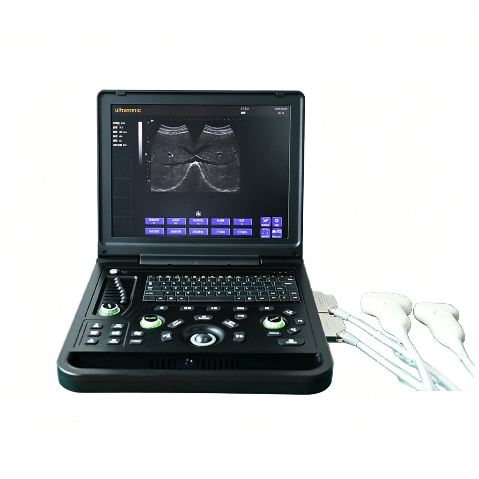 All-Digital Laptop Ultrasound Diagnostic System Portable for Doctor Office