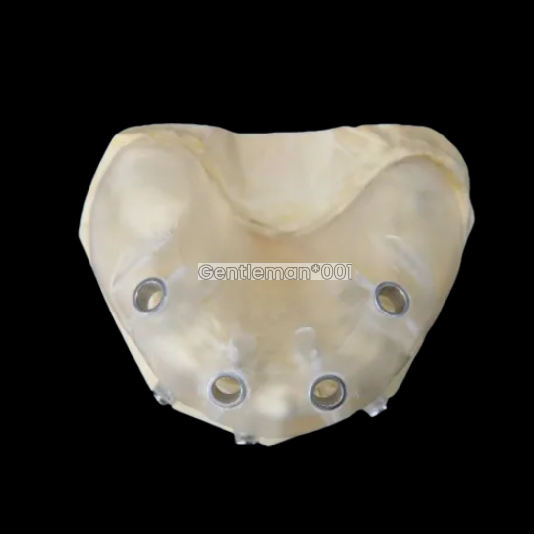 10Pcs Dental Digital Guided Sleeves Implant Template Fixed Universal ITI DIO DEN