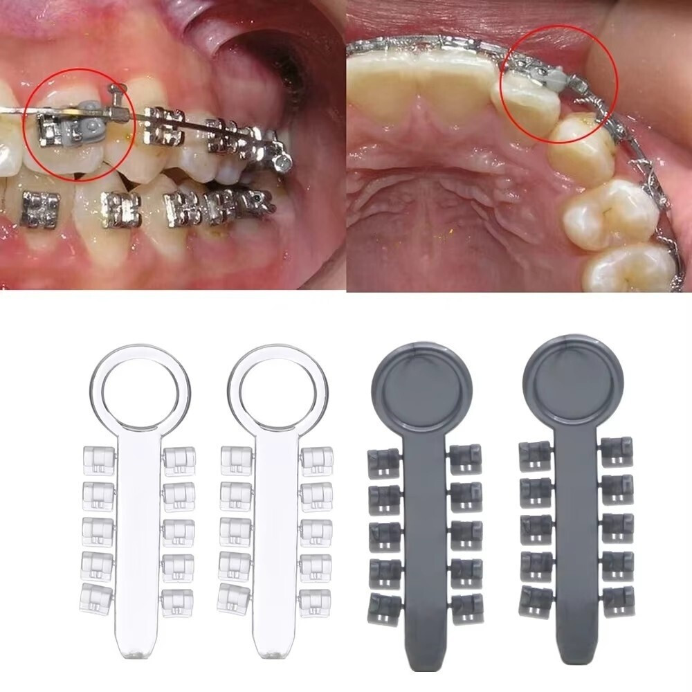 10 Sticks/Pack Dental Orthodontic Elastics Rubber Rotation Wedge Rotary Pads