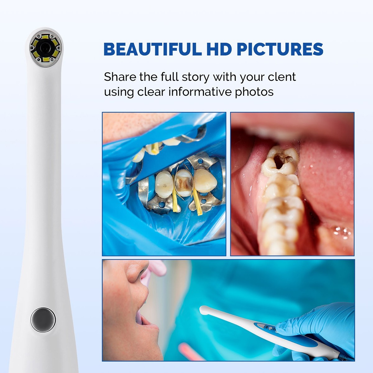 6 LED Dental USB Intraoral Camera Imaging Intra Oral Endoscope+Software U Disk