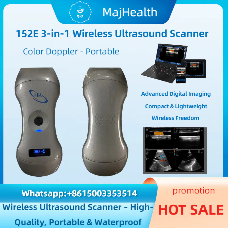 152E 3-in-1 Wireless Ultrasound Scanner w/Color Doppler – Portable