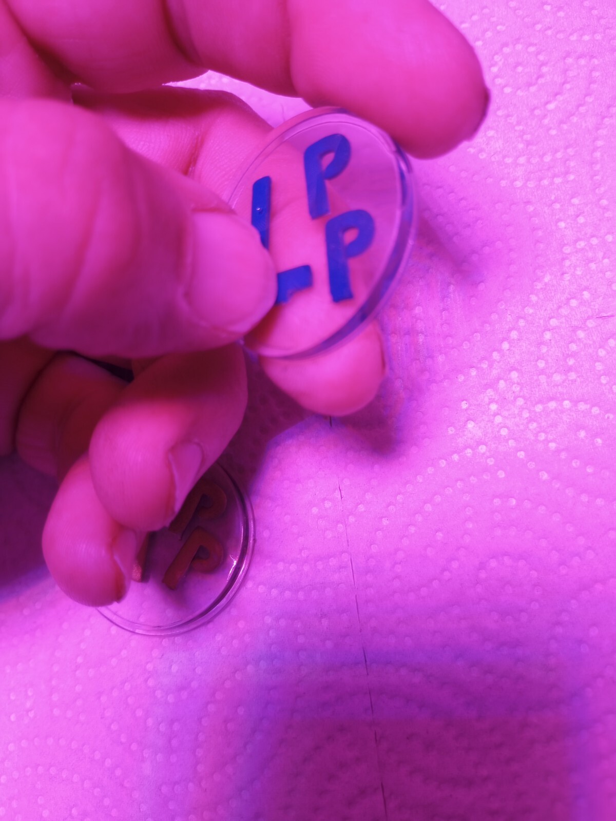 X-ray Markers With Initials PP One Set Ready To Ship
