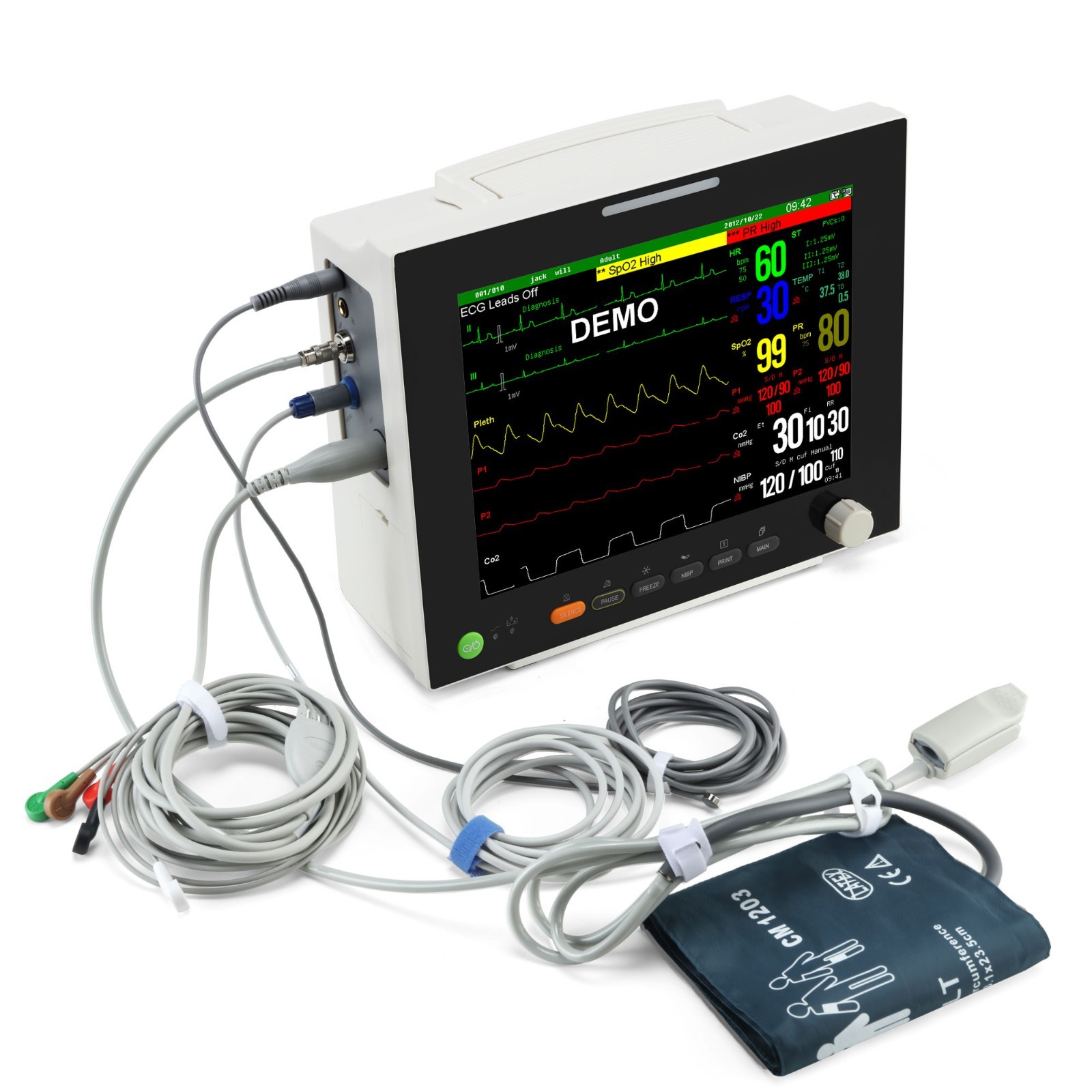 12.1″ TFT Patient Monitor ECG/NIBP/SPO2/RESP/TEMP trends/alarm with Printer