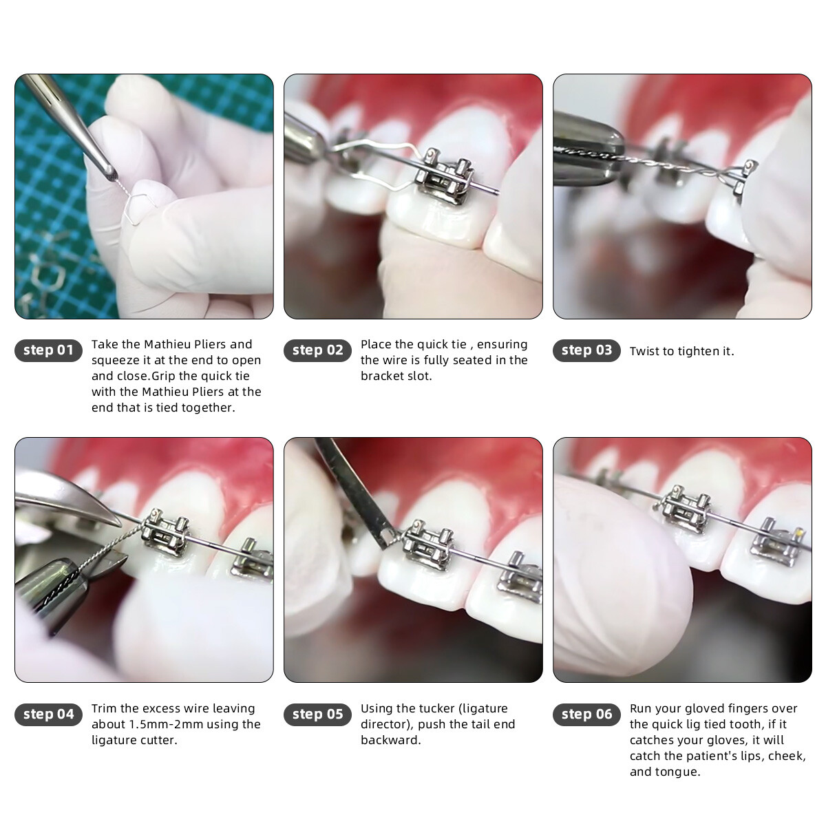 Dental Orthodontic Preformed Wire Metal Steel Ligature Ties Short Long Twist