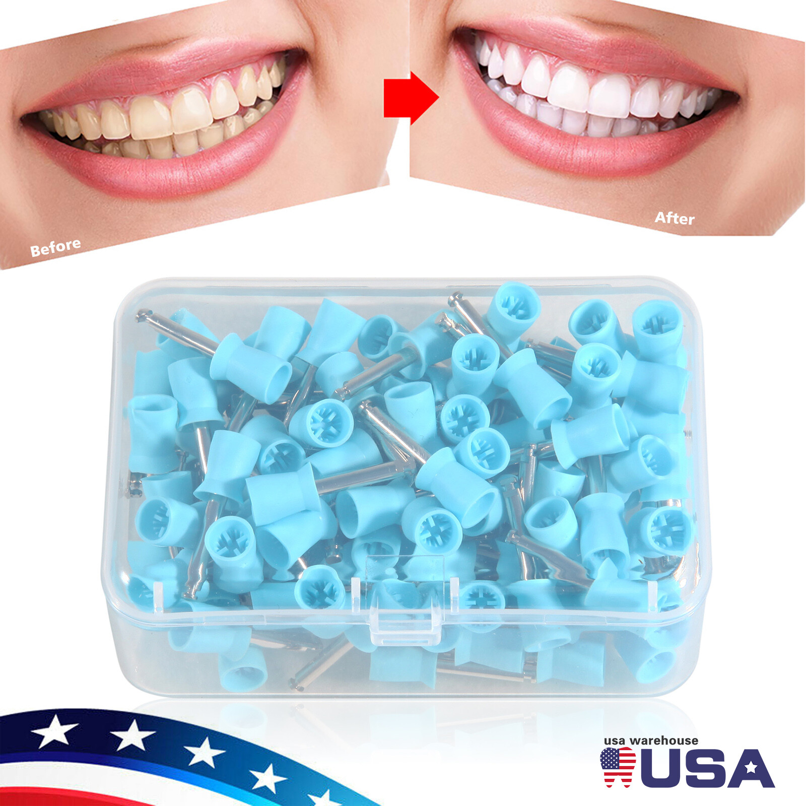 100x Dental Latch type Rubber Polishing Cups Brushes Tooth Prophy Polisher blue