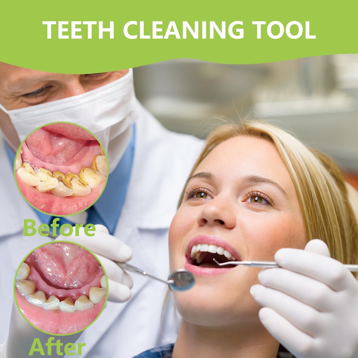 Dental Tools, Professional Teeth Cleaning Oral Care Hygiene Kit, Stainless Steel