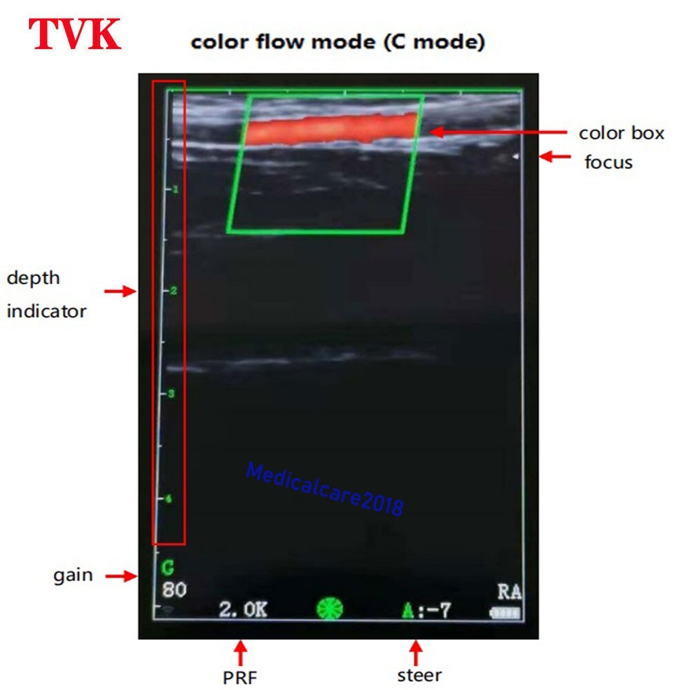 Portable Wireless WiFi Color Doppler linear Ultrasound Scanner, 128 Elements