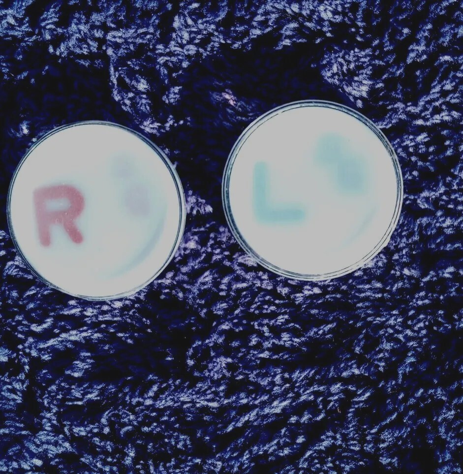 X-ray Markers With Initials SG One Set Ready To Ship!