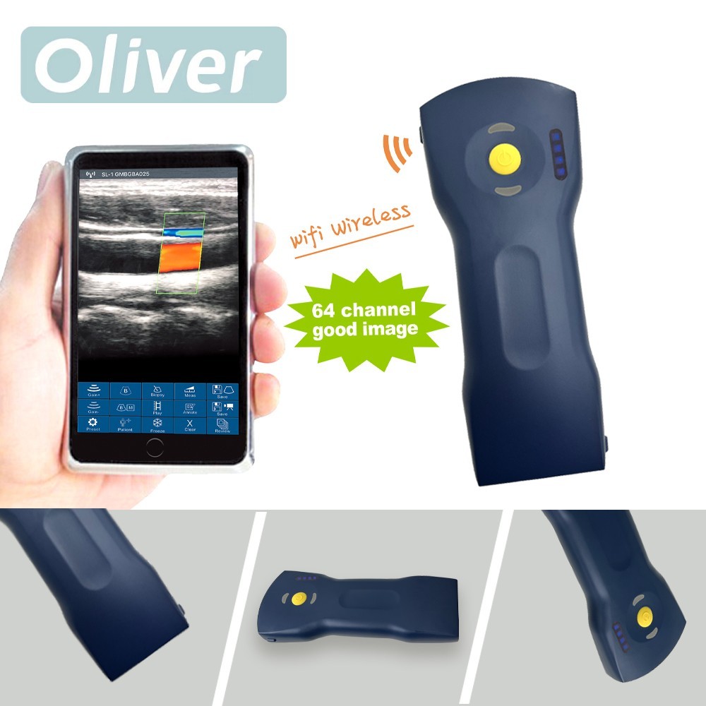 256E 3 in 1 Wifi Wireless Color Ultrasound Doppler Scanner