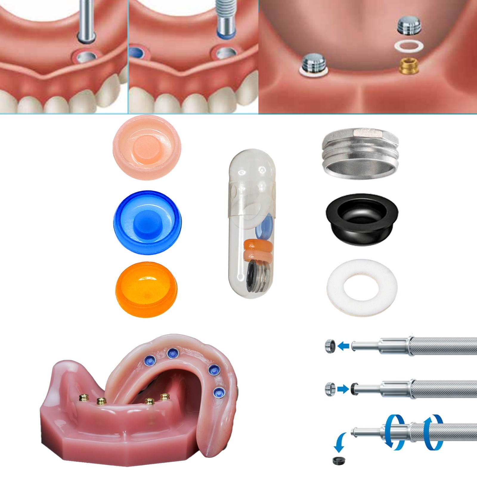 US Locator Overdenture Male Caps PEEK Retention Inserts Lab Housing 20pcs/set
