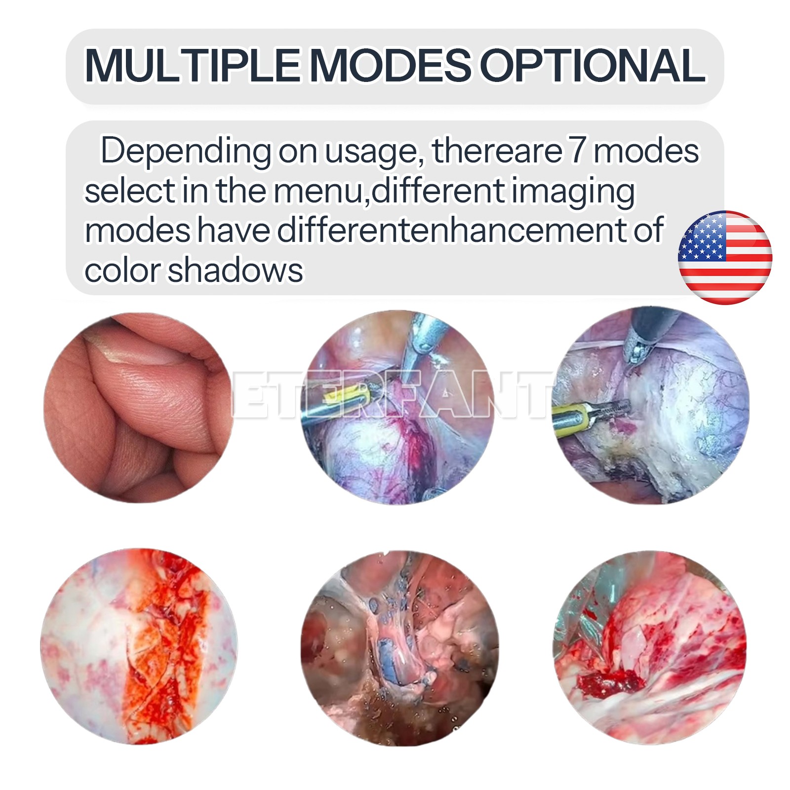 TU-Y1 1080p Full HD ENT Endoscopy Laparoscopic / TU-L1 Medical Cold Light Source