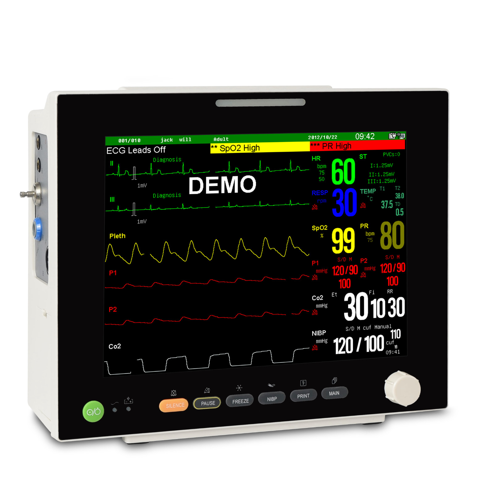 12.1″ TFT Patient Monitor ECG/NIBP/SPO2/RESP/TEMP trends/alarm with Printer