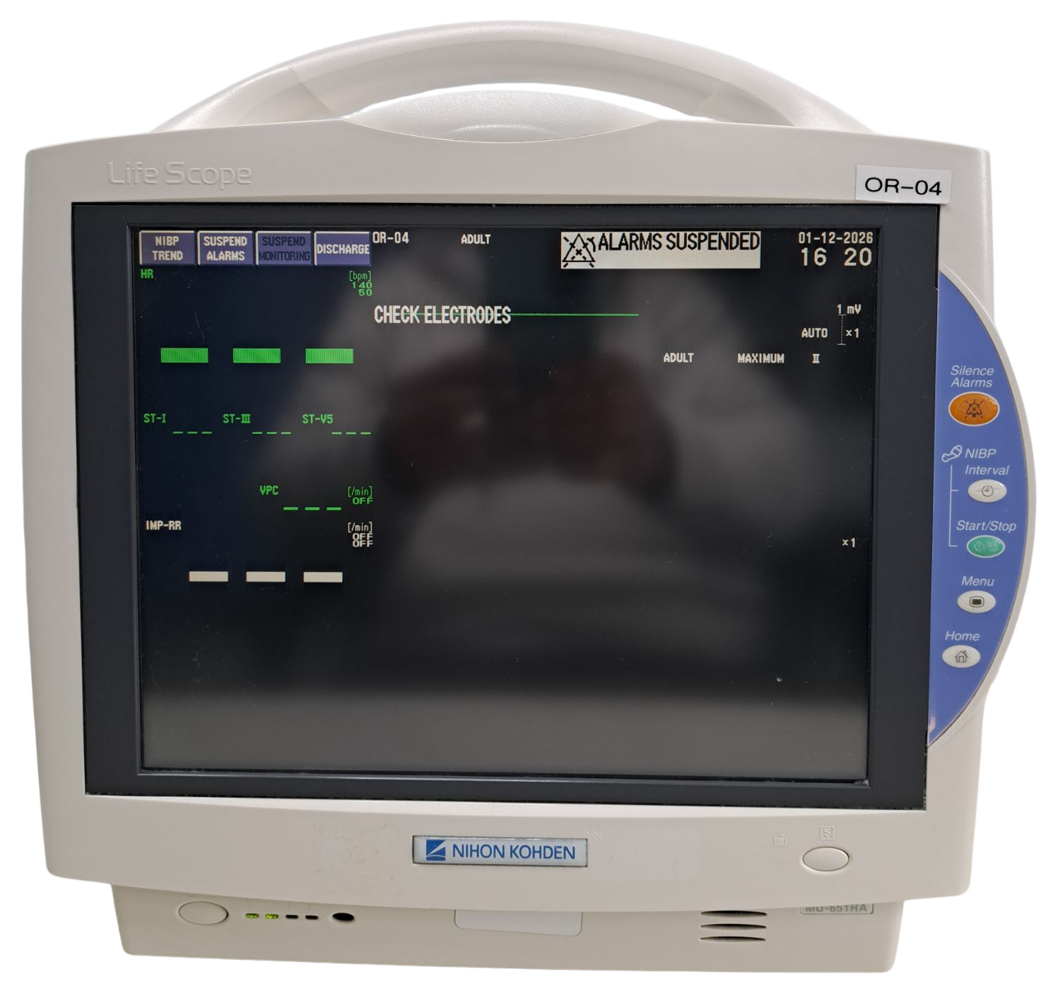 NIHON KOHDEN BEDSIDE PATIENT MONITOR