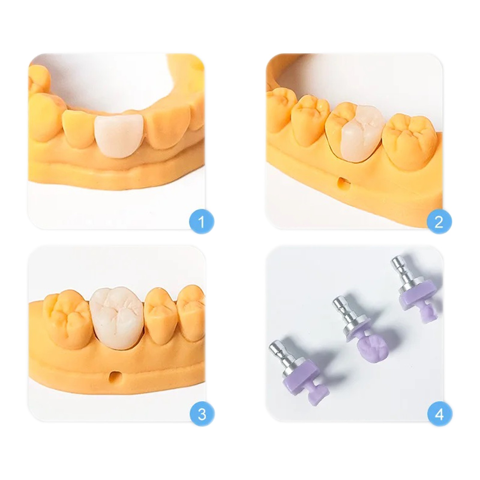 Lithium Disilicate Glass Ceramic IPS e.max CAD HT/LT Blocks For inLab C14/5pcs