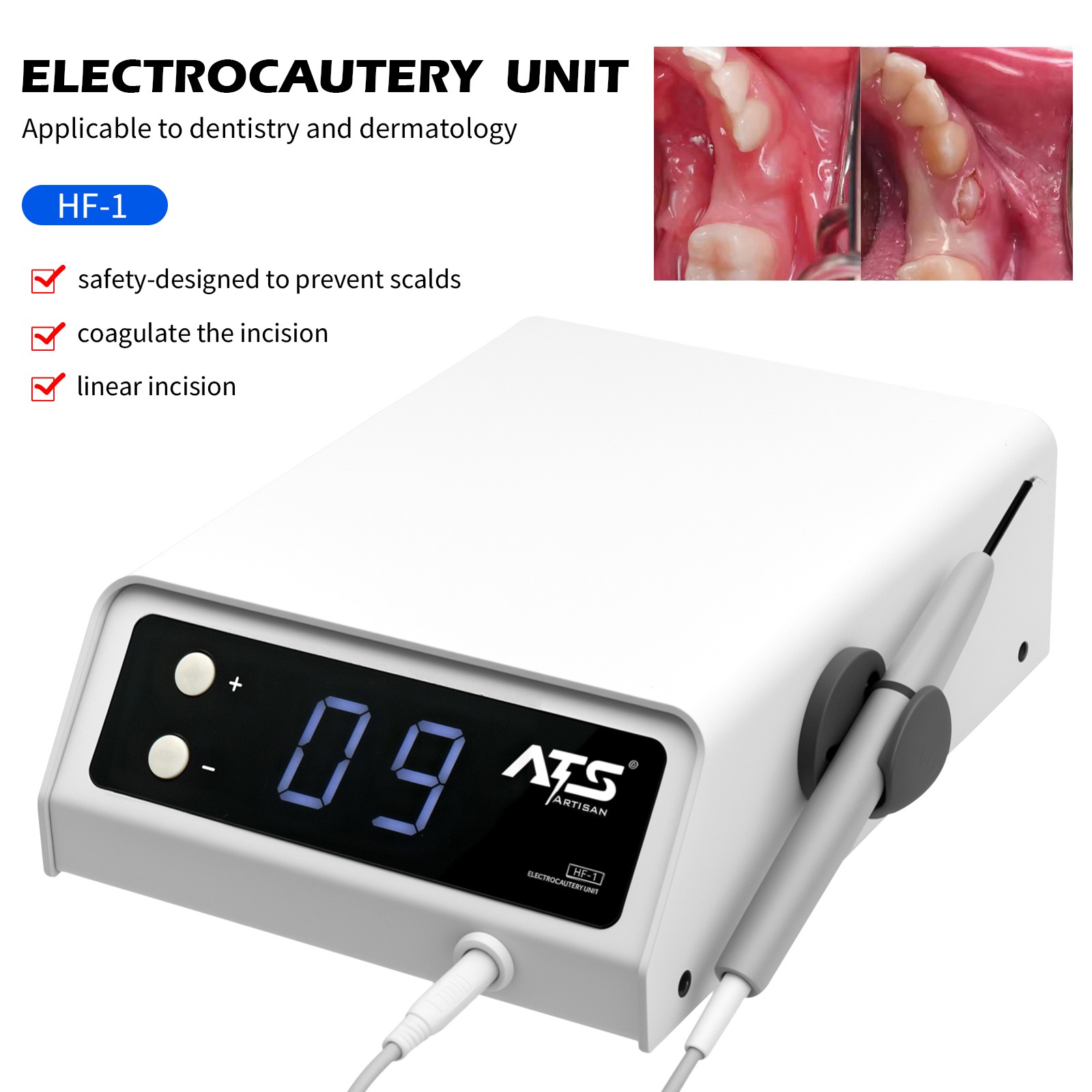 Electrosurgery Unit Dental Electro Dentisty System – High Frequency 110V