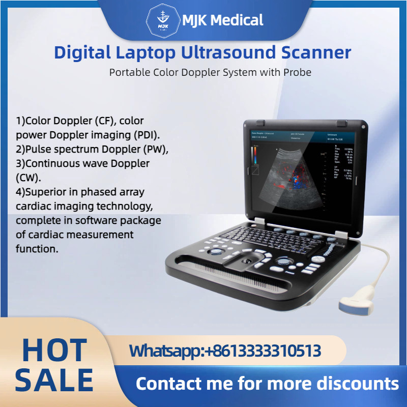 Digital Laptop Ultrasound Scanner – Portable Color Doppler System with Probe
