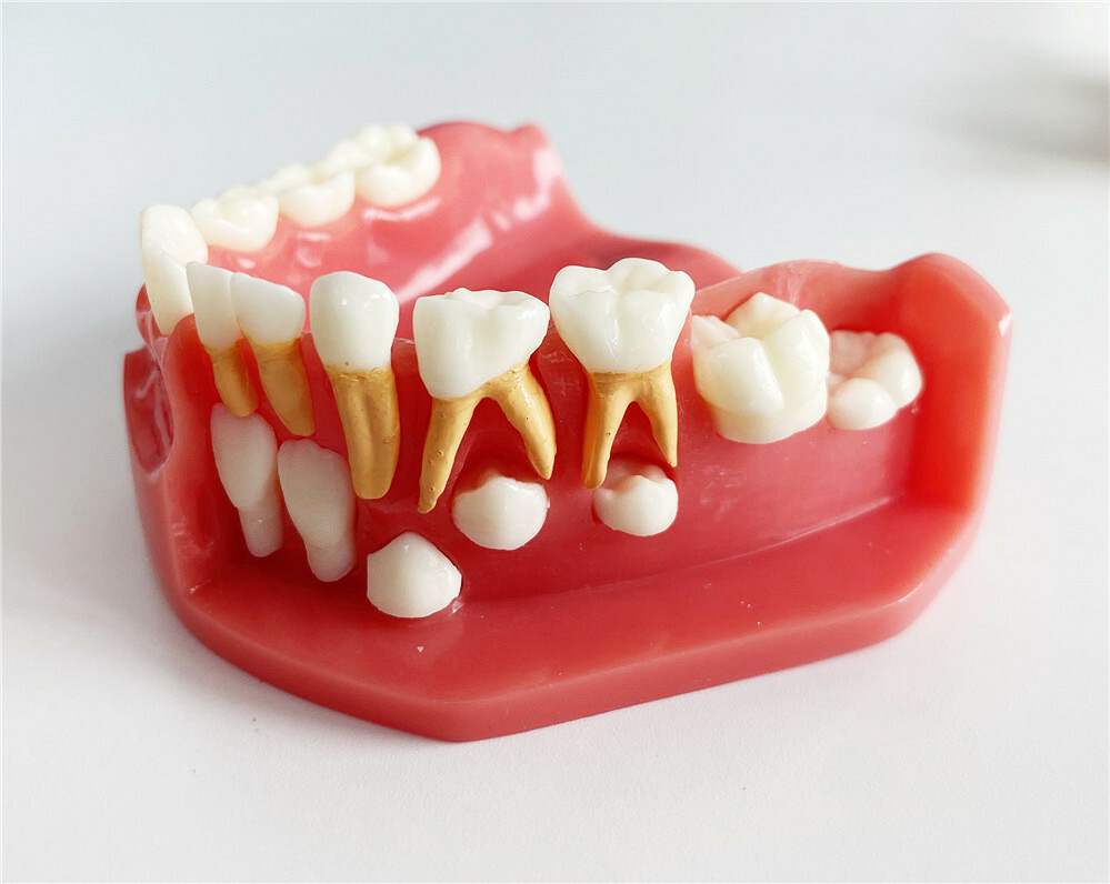 Dental Teaching Pediatrics Teeth Children 5-9Years Old Permanent Alternate Model