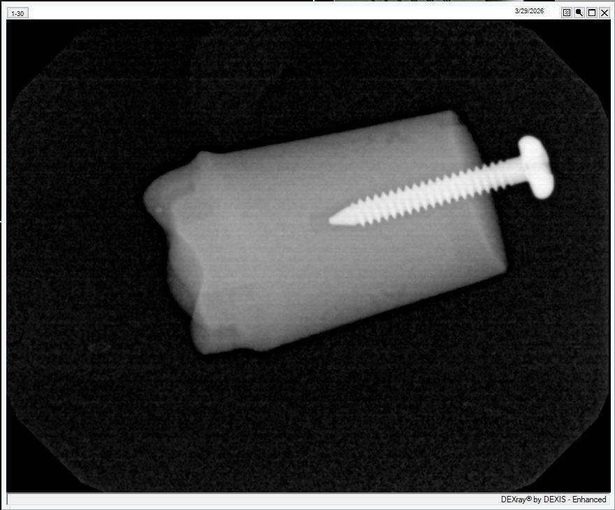 Dexis Platinum Sensor With Calibration Files – See description
