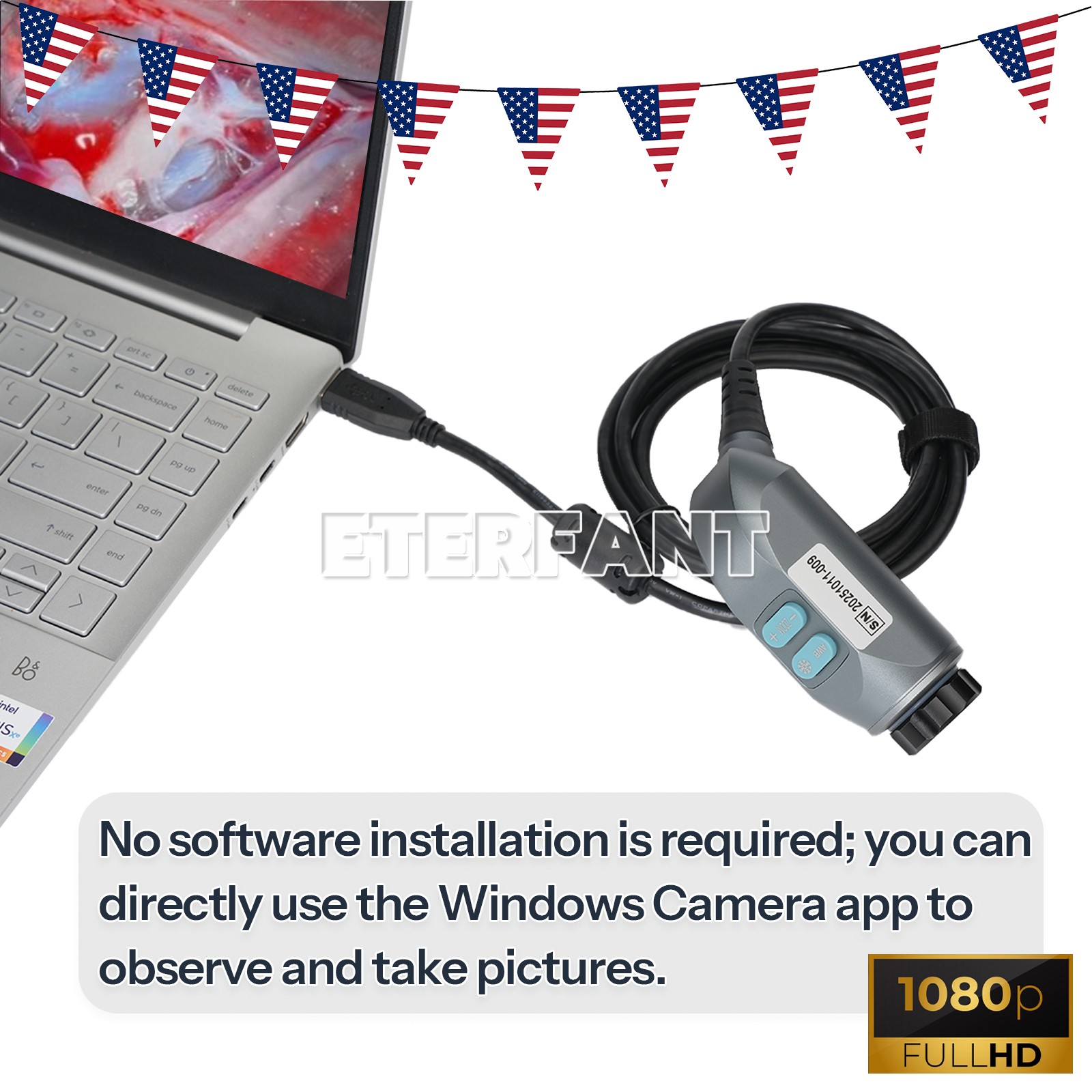 1080P Full HD USB Medical Endoscope Camera ENT Laparoscopic Surgery Inspection