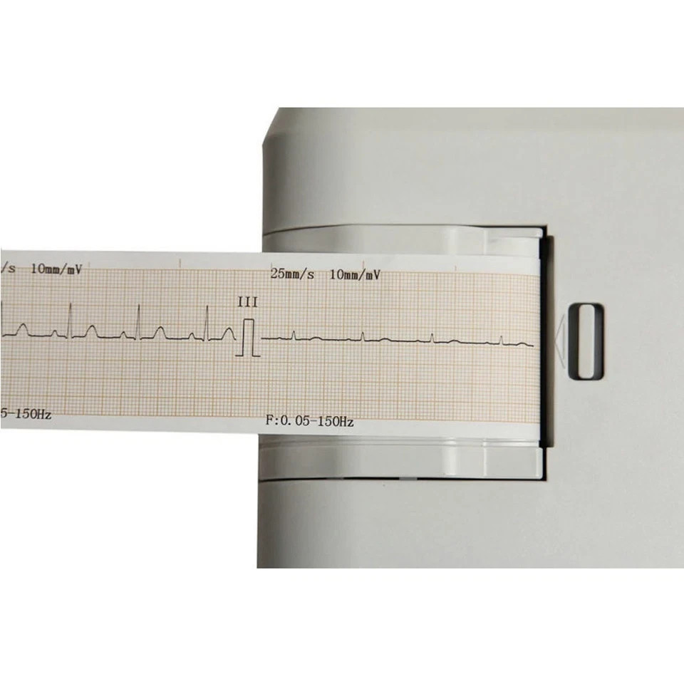 1-Channel 12-Lead Digital EKG Machine – Medical ECG100G Electrocardiograph