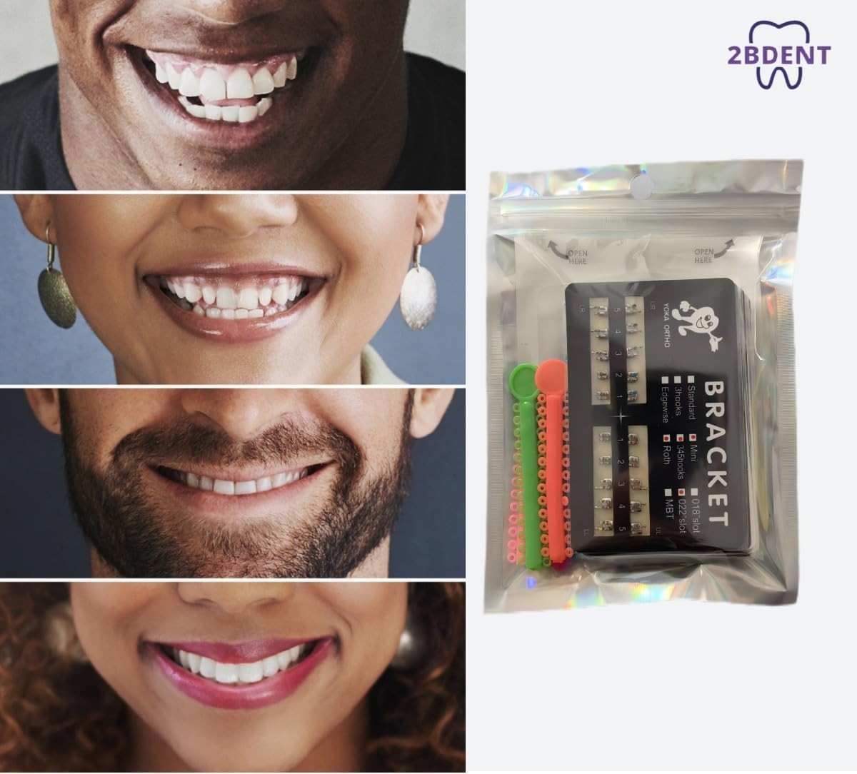 Dental Braces Kit Orthodontic Metal Braces Kit, Orthodontic Ligature Ties Kit